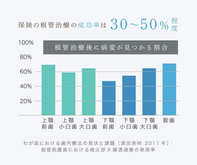 保険の根管治療の成功率は30〜50％程度